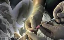 流一些白色粘稠东西是排卵期吗