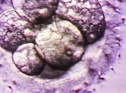 试管婴儿顺利率有40%就谢天谢地了